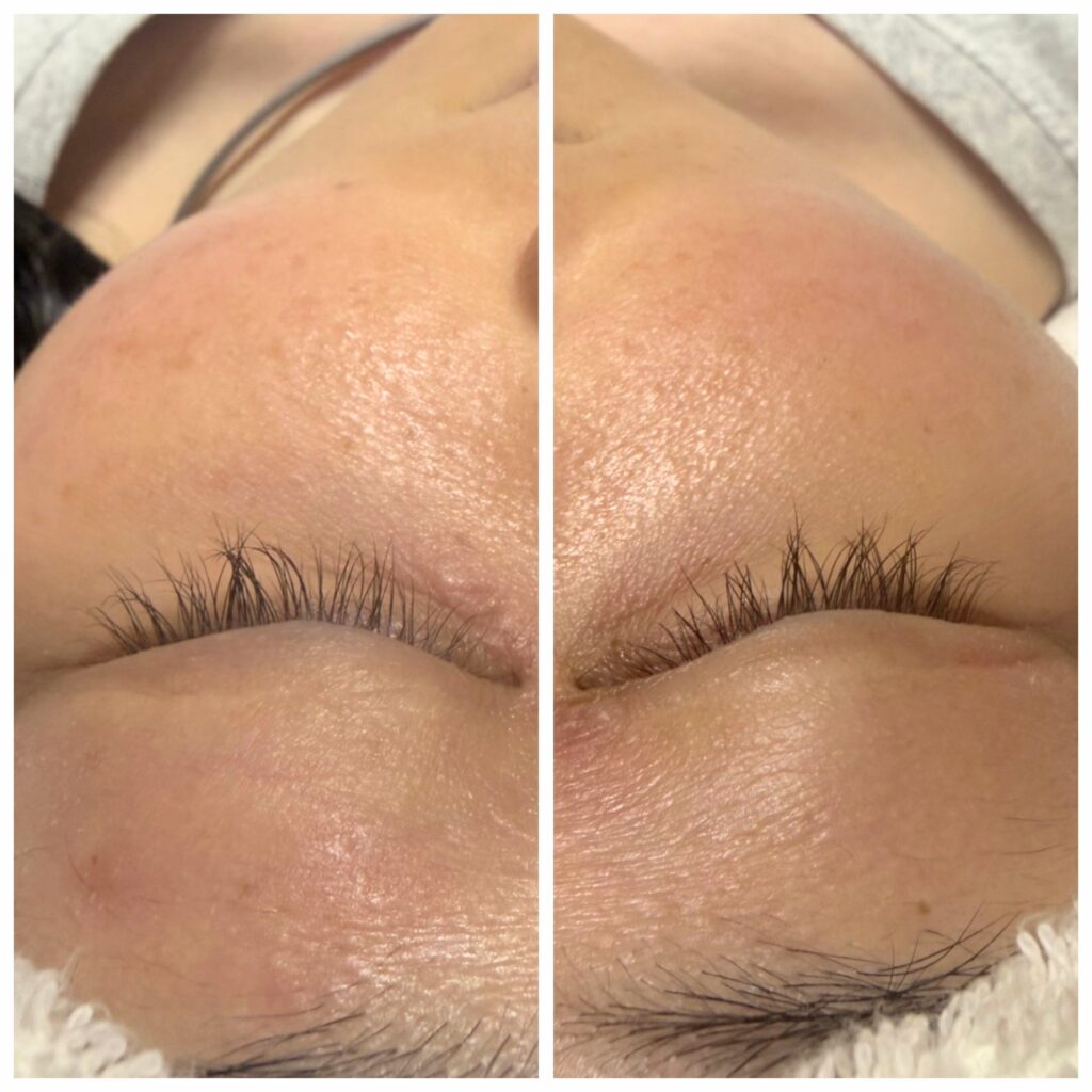 エクストラロングラッシュビフォー